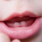 La dentizione da latte: tempi di eruzione, importanza dei dentini, segnali che il dentino sta spuntando