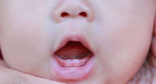 I primi sintomi della dentizione del neonato