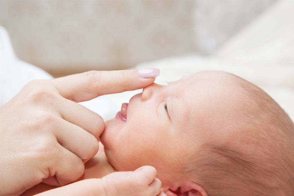 Management of rhinorrhea in the newborn