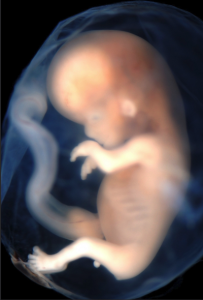 Figure 1 - Fetus in the amniochorionic sac